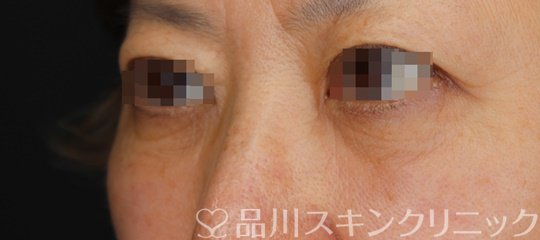 症例NO.65092のAFTER写真