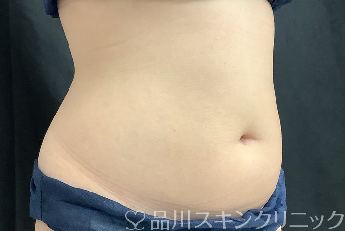 症例NO.68158のBEFORE写真