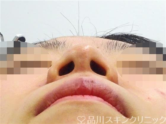 症例NO.47189のBEFORE写真