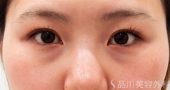 症例NO.60257のBEFORE写真