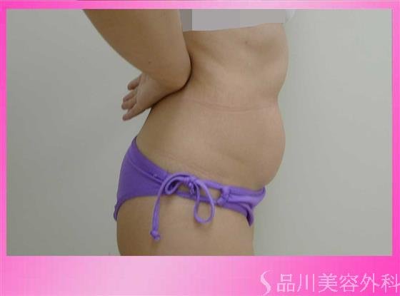 症例NO.36048のBEFORE写真