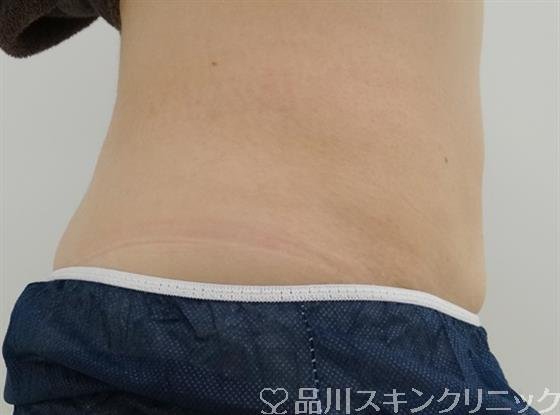 症例NO.25609のBEFORE写真