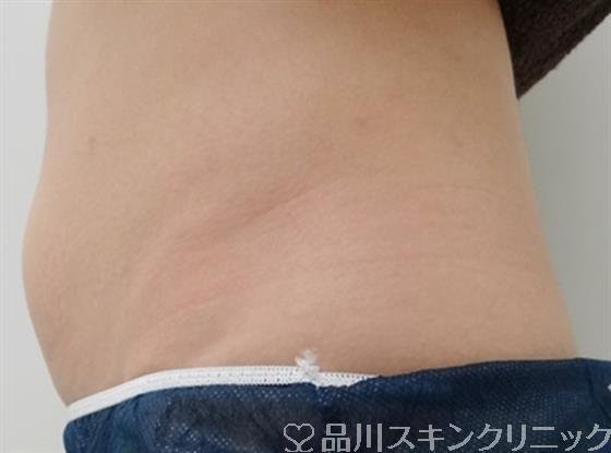 症例NO.25620のBEFORE写真