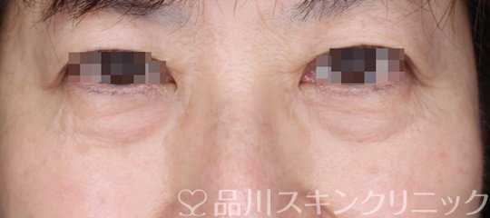 症例NO.65092のBEFORE写真