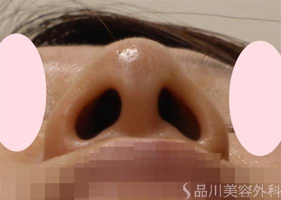 症例NO.28420のBEFORE写真