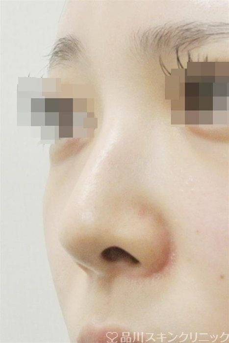 症例NO.36167のBEFORE写真