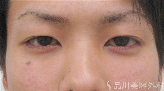 症例NO.10734のBEFORE写真