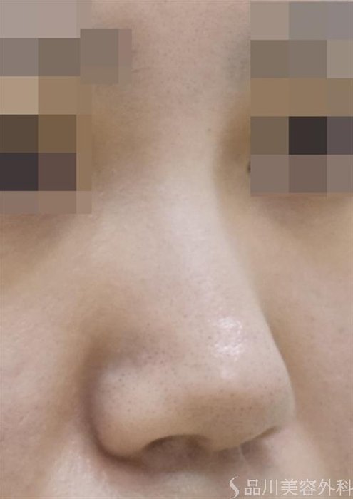 症例NO.58191のBEFORE写真