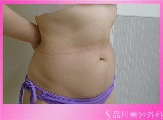 症例NO.36048のBEFORE写真