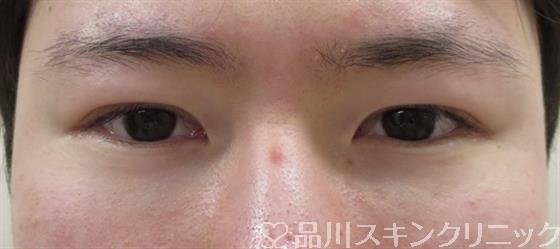 症例NO.40980のBEFORE写真