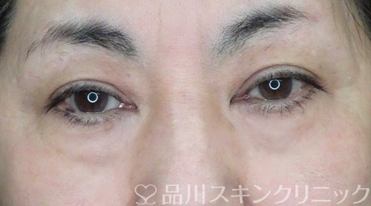 症例NO.65641のBEFORE写真