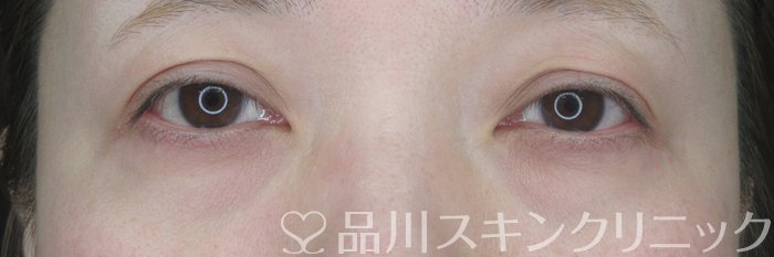 症例NO.63007のBEFORE写真