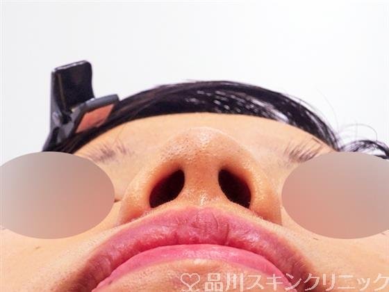 症例NO.49219のAFTER写真