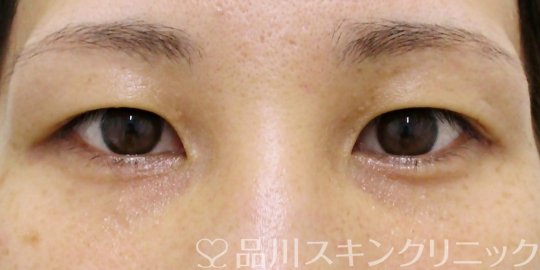 症例NO.69195のBEFORE写真