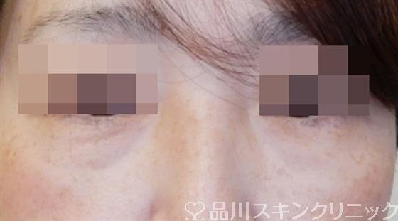 症例NO.50422のBEFORE写真