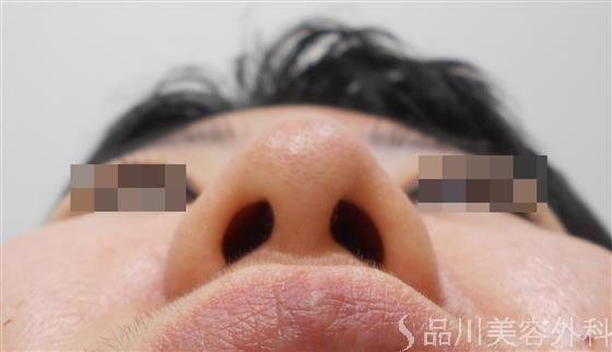 症例NO.21754のBEFORE写真