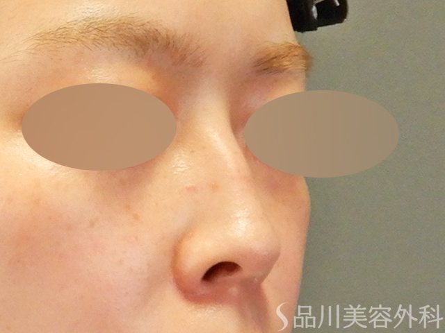 症例NO.65002のBEFORE写真