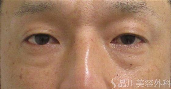 症例NO.59792のBEFORE写真