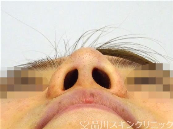 症例NO.47158のAFTER写真