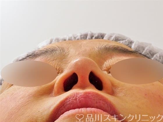 症例NO.50280のBEFORE写真