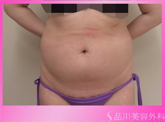 症例NO.40419のBEFORE写真