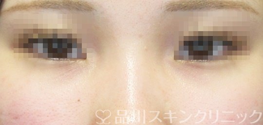 症例NO.68391のBEFORE写真