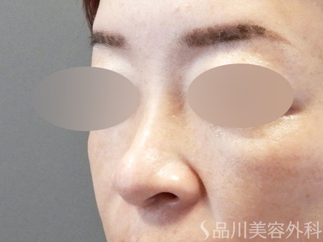 症例NO.66774のBEFORE写真