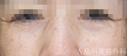 症例NO.69129のAFTER写真