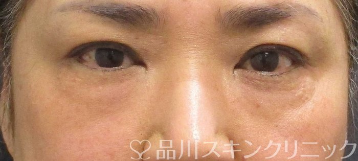 症例NO.65769のBEFORE写真