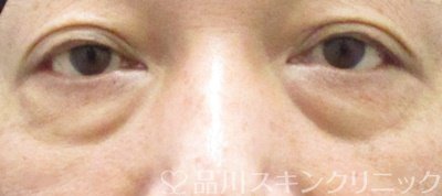 症例NO.66489のBEFORE写真