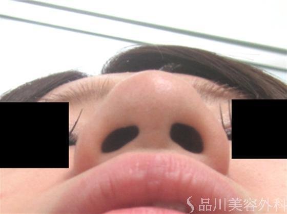 症例NO.6719のBEFORE写真