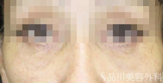 症例NO.67506のAFTER写真