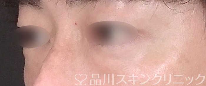 症例NO.65860のBEFORE写真