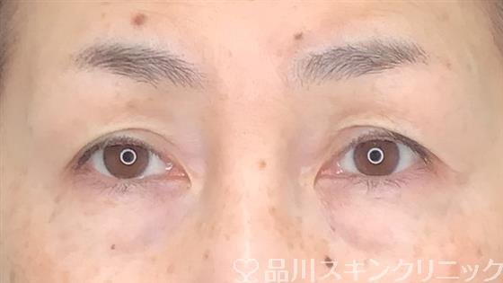 症例NO.59667のBEFORE写真