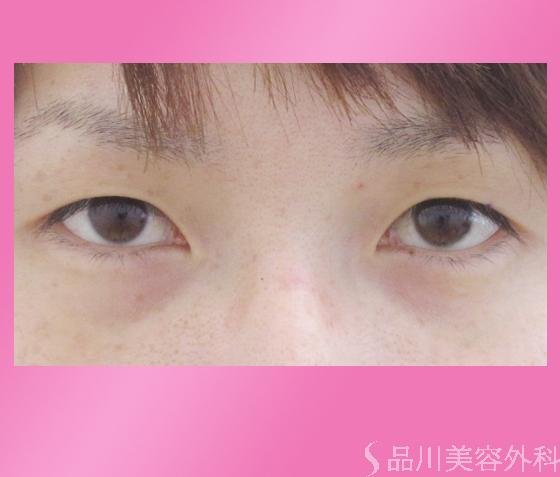 症例NO.380のBEFORE写真