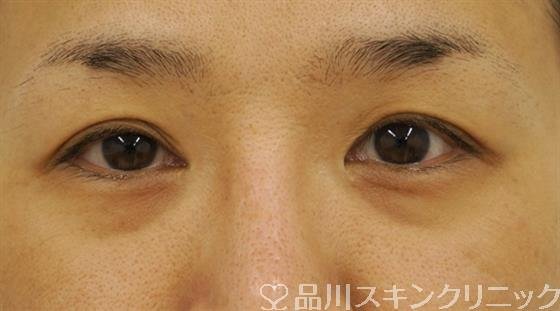 症例NO.40182のBEFORE写真