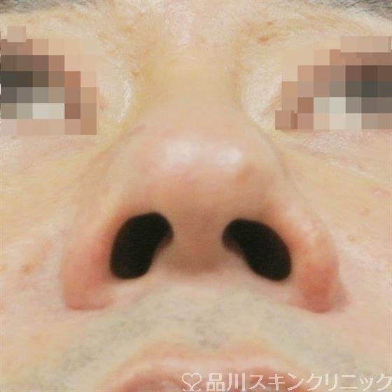 症例NO.36386のBEFORE写真