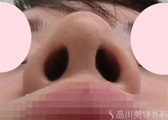 症例NO.28508のAFTER写真