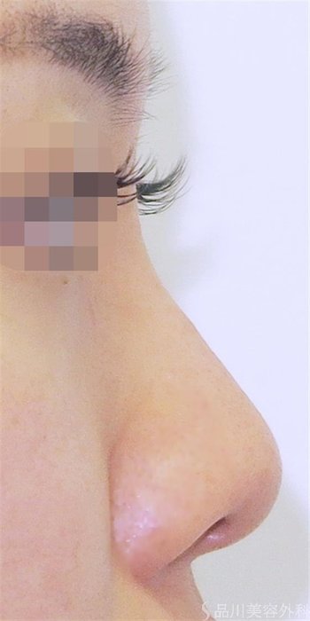 症例NO.40720のBEFORE写真