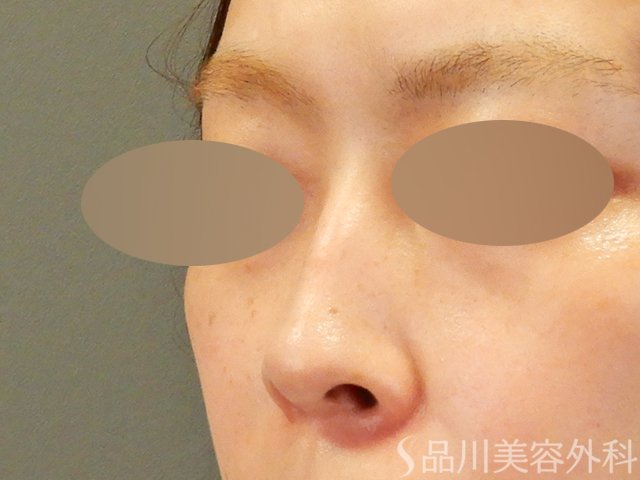 症例NO.65002のBEFORE写真