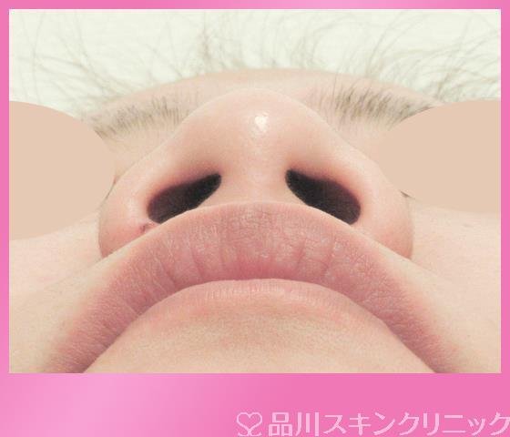 症例NO.27050のBEFORE写真