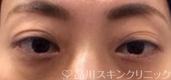 症例NO.63940のBEFORE写真