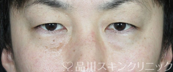 症例NO.63083のBEFORE写真