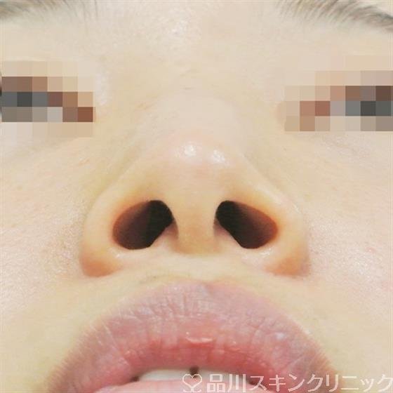 症例NO.31473のBEFORE写真