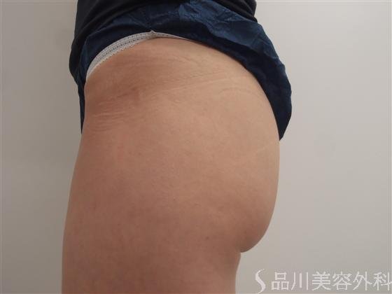 症例NO.16382のBEFORE写真