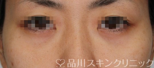 症例NO.64805のAFTER写真