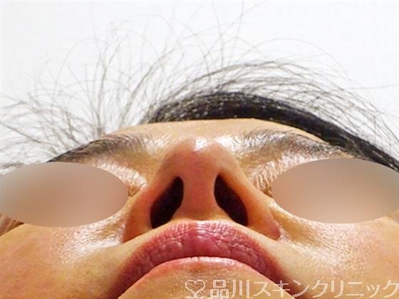 症例NO.50280のAFTER写真