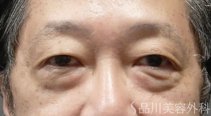 症例NO.66082のBEFORE写真