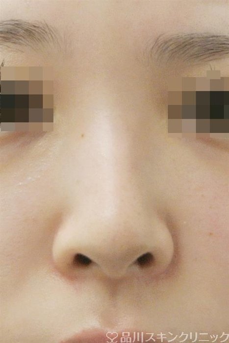 症例NO.36167のBEFORE写真