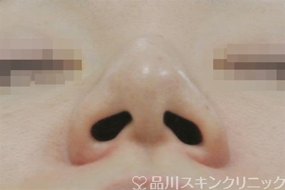 症例NO.29609のBEFORE写真